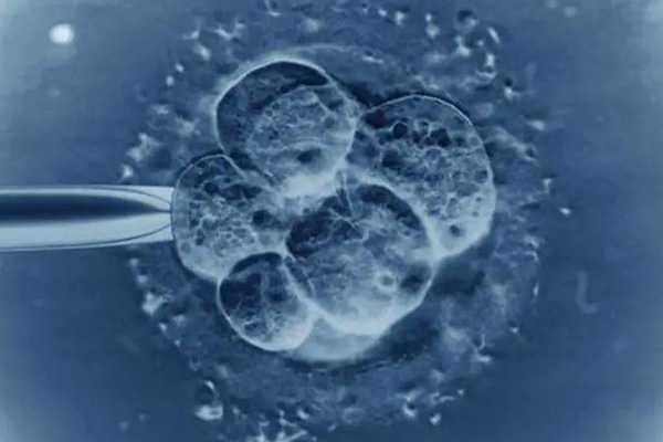 试管婴儿中冻胚和鲜胚有什么不同？不选鲜胚的原因